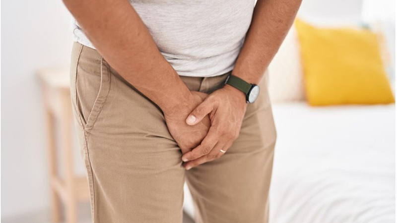 Varicocele